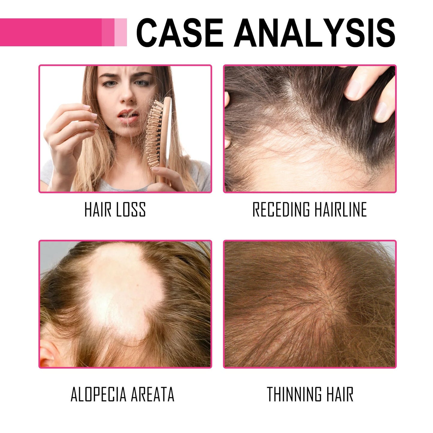 Nourishing Oil Treatment for Dry and Damaged Hair