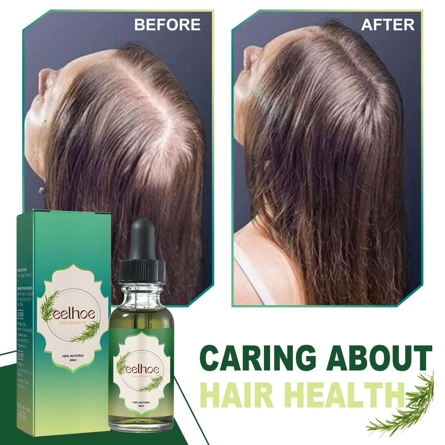 Revitalizing Hair Strengthening Growth Treatment