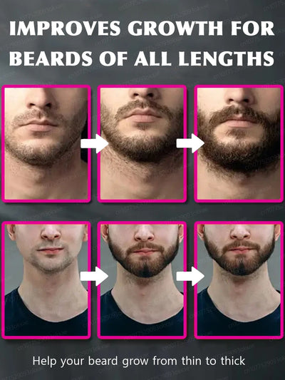 Beard growth essence. It helps your beard grow quickly, and is a must-have for mature men. It makes you look more manly and is e