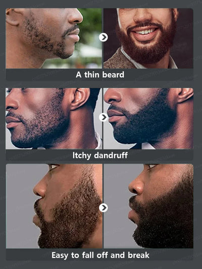 Beard growth essence. It helps your beard grow quickly, and is a must-have for mature men. It makes you look more manly and is e